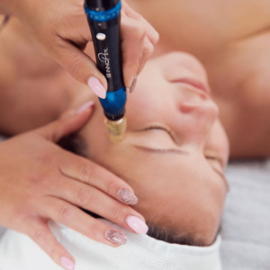 Microneedling